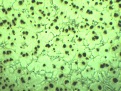 The microstructure of Ni-resist D-2M centrifugally cast tube produced by LAWAI INDUSTRIAL CORPORATION